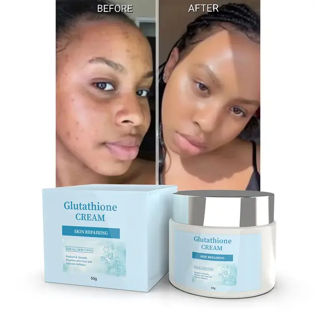 creme visage glutathion obb beaute 50g, dissolvant de tâches et cicatricielle